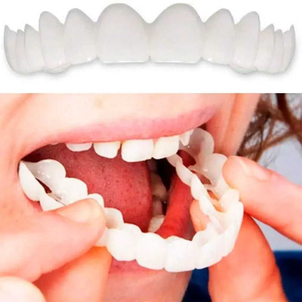Lente Dental White 
Snap On Smile